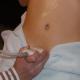 Ultrazvuk bubrega i mjehura: priprema za proučavanje žena i muškaraca
