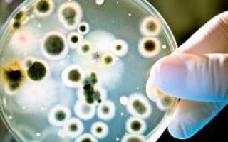 अवायवीय एरोबिक बैक्टीरिया केवल ऑक्सीजन वाले वातावरण में रहते हैं