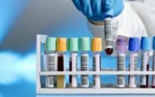 Pouzdanost testova na HIV: šta određuje tajming testa