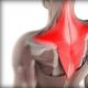 Napetost mišića u vratu: kako si pomoći?