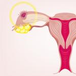 Uzroci ružičastog iscjetka prije menstruacije Krv je potekla 10 dana prije menstruacije