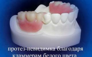 Flexibilné zubné protézy: ceny, recenzie, fotografie Ako si vybrať mäkké zubné protézy