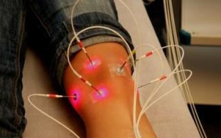 Tačke mršavljenja u kineskoj medicini - akupunkturna terapija za tijelo