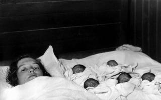 The most numerous twins born at one time 5 twins