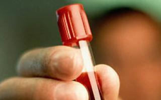 Krv na hepatitídu HIV, ako darovať