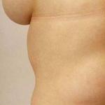 Jak uniknąć operacji tłuszczaka: sprawdzone środki i metody