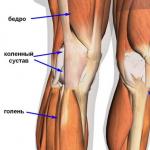 Tendinitis patelarnog ligamenta Tendinitis prednjeg ukrštenog ligamenta kolena